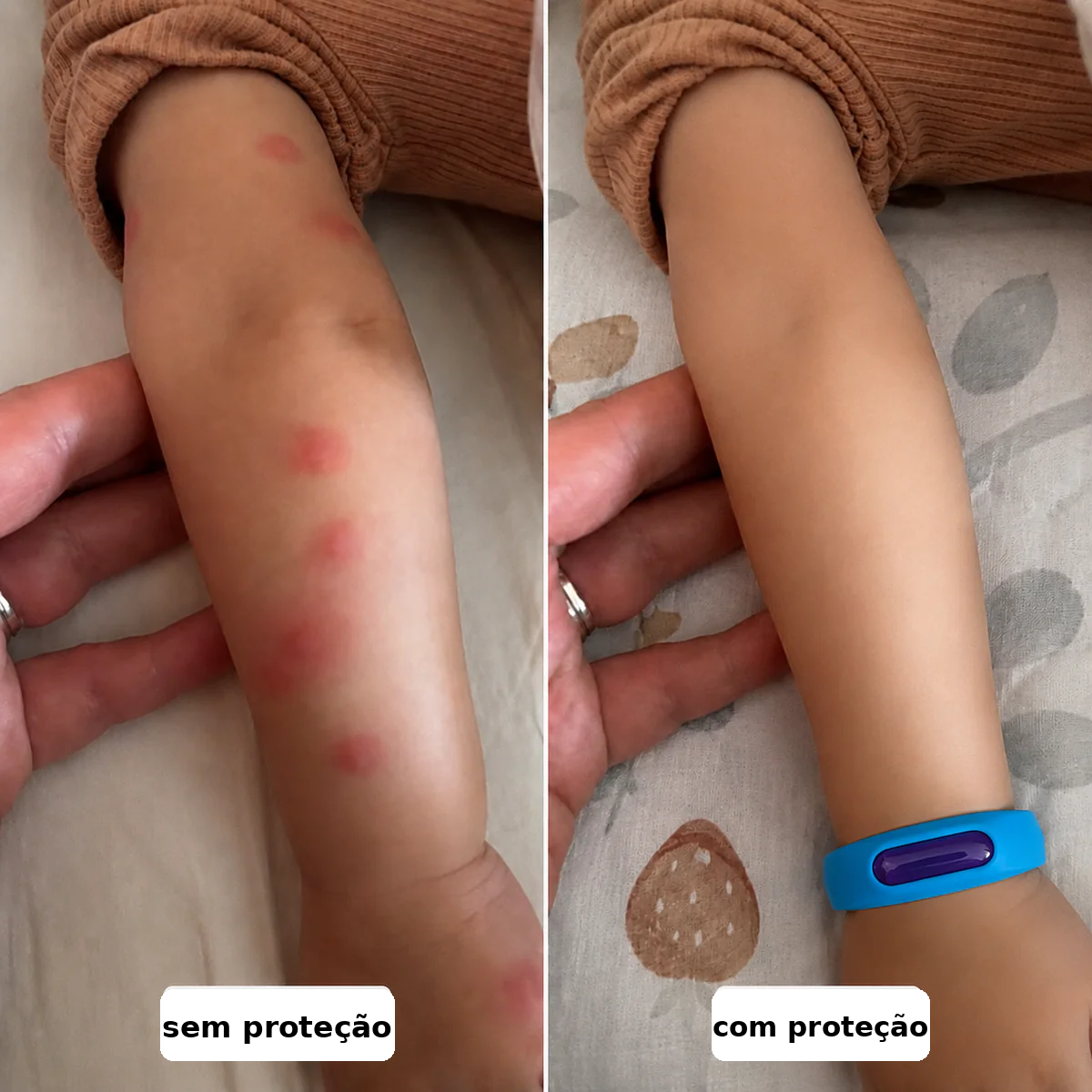 Solvix - Pulseira repelente de Mosquitos - Imagem 3