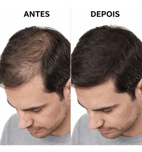 Disfarça calvície, falhas e entradas Maquiagem Capilar Suake Unisex (ORIGINAL) - Imagem 6
